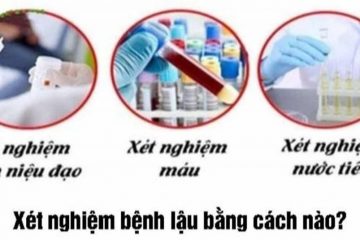 Xét nghiệm bệnh lậu ở đâu, chi phí hết bao nhiêu tiền?