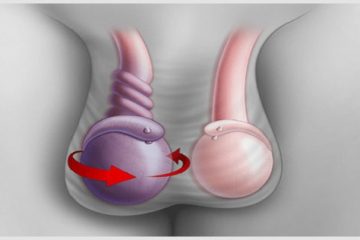 Đau tinh hoàn do đâu? Mách bạn cách khắc phục hiệu quả