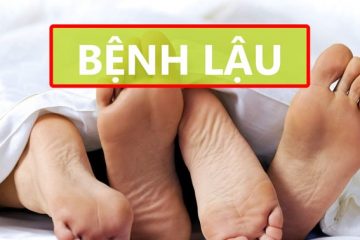 XÉT NGHIỆM BỆNH LẬU LẤY NGAY