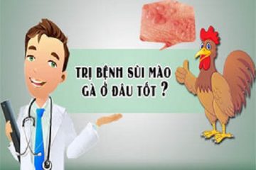 DẤU HIỆU BỆNH SÙI MÀO GÀ VÀ CÁCH HỖ TRỢ ĐIỀU TRỊ MỚI HIỆN NAY